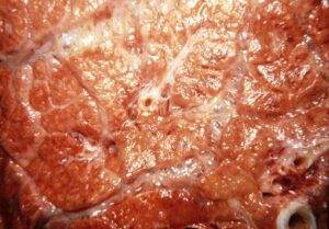 Infectious Bovine Rhinotracheitis 